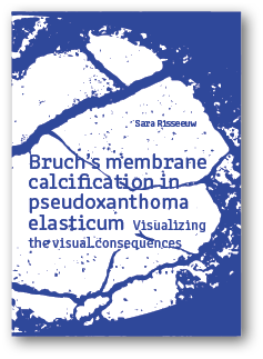 Foto (kleur) cover van Dr. S. Risseeuw's proefschrift